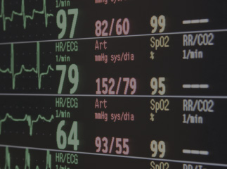 Deciphering the Why,When and How of RBM